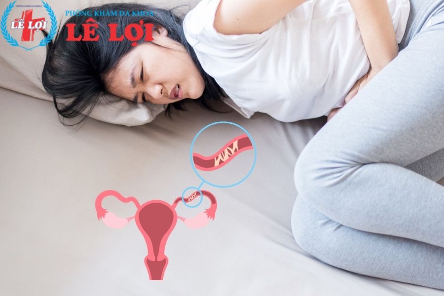Thai ngoài tử cung bao lâu thì đau bụng?