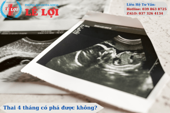 Thai 4 tháng có phá được không?