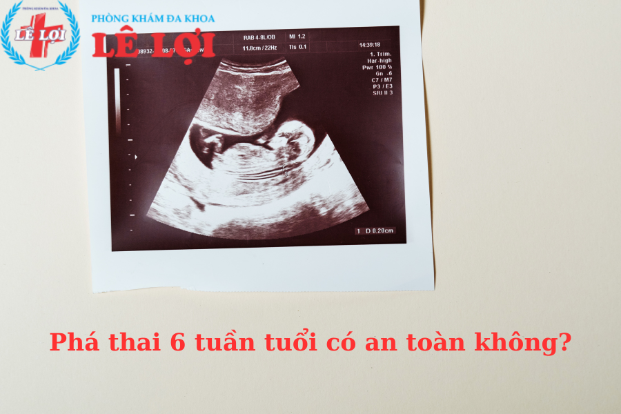 Phá thai 6 tuần tuổi có an toàn không?