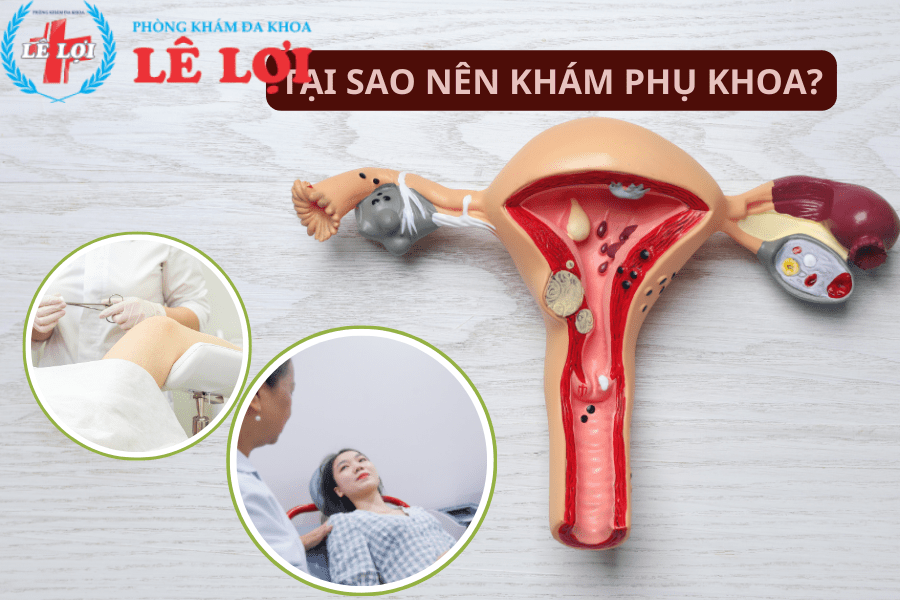 Tại sao nên khám phụ khoa?