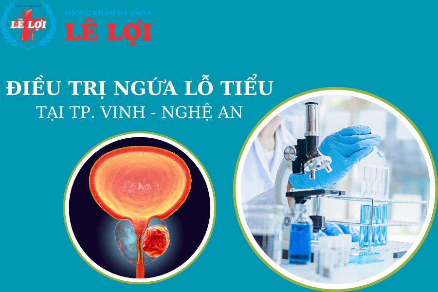 Điều trị ngứa lỗ tiểu ở nam và nữ tại TP Vinh