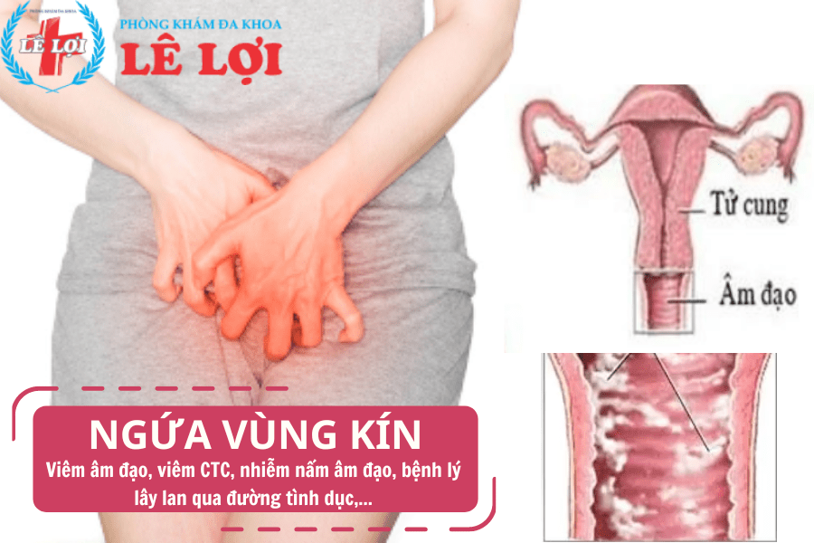 Nguyên nhân bị ngứa vùng kín chị em